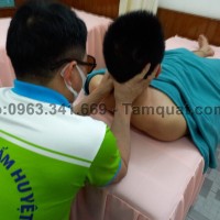 Cạo gió giác hơi tại nhà [Lợi ích và dịch vụ uy tín]