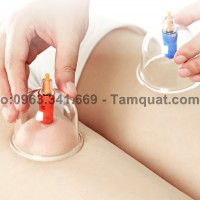 Giác hơi ở đâu uy tín, lành mạnh?