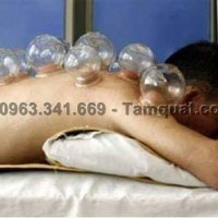 Hướng dẫn giác hơi cạo gió tại nhà an toàn, hiệu quả