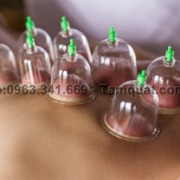 Bạn biết gì về liệu pháp giác hơi, cạo gió là gì? Giác hơi cạo gió có tốt không? 